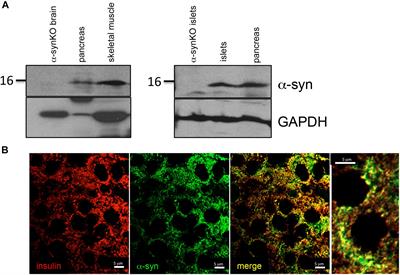 α-Synuclein Regulates Peripheral Insulin Secretion and Glucose Transport